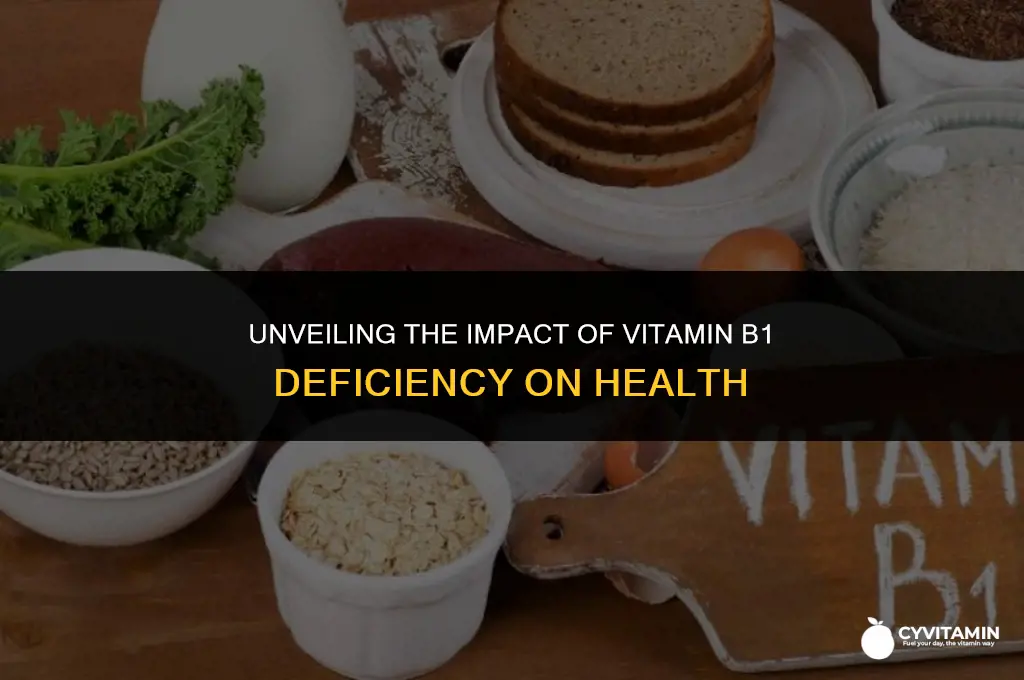 what does vitamin b1 deficiency cause