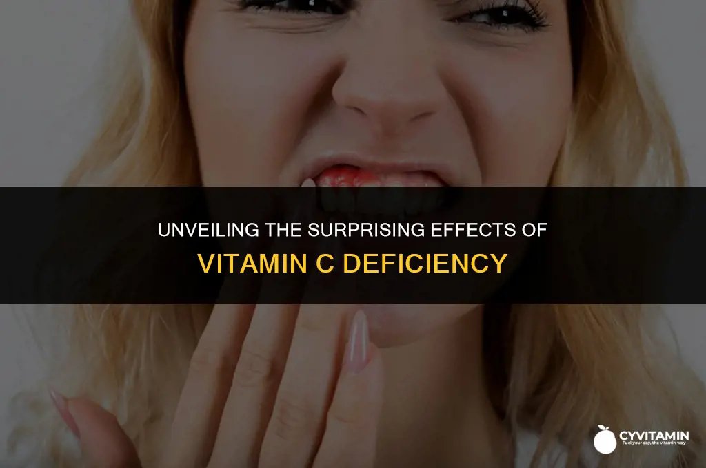what does vitamin c deficiency cause
