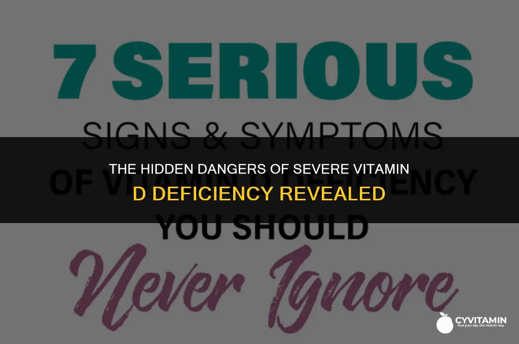 what happens if you are severely deficient in vitamin d