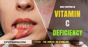 Unveiling the Hidden Dangers of Vitamin C Deficiency
