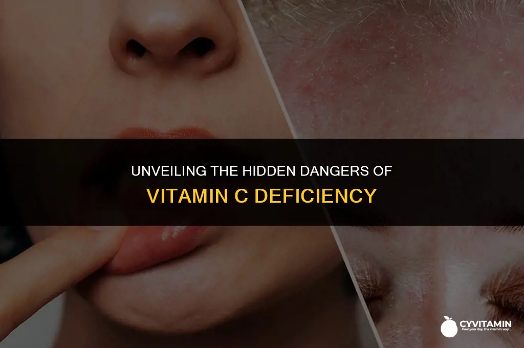 what happens in vitamin c deficiency