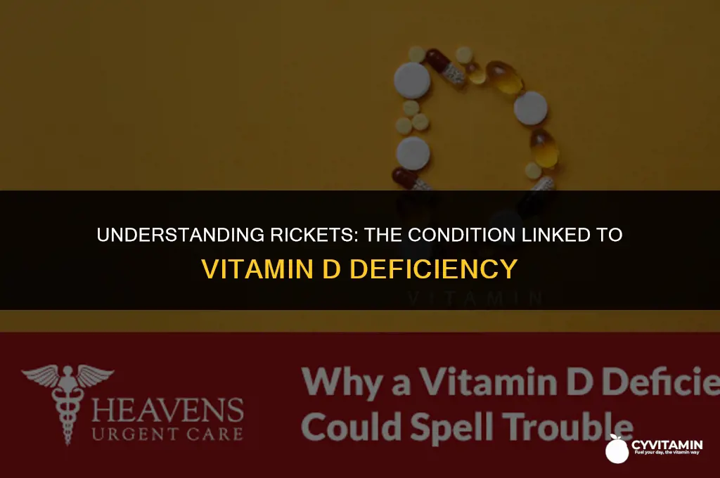 what is a vitamin d deficiency called