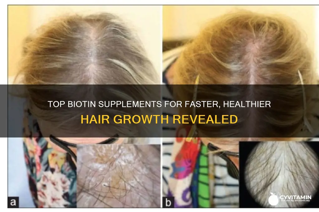 what is the best biotin vitamin for hair growth