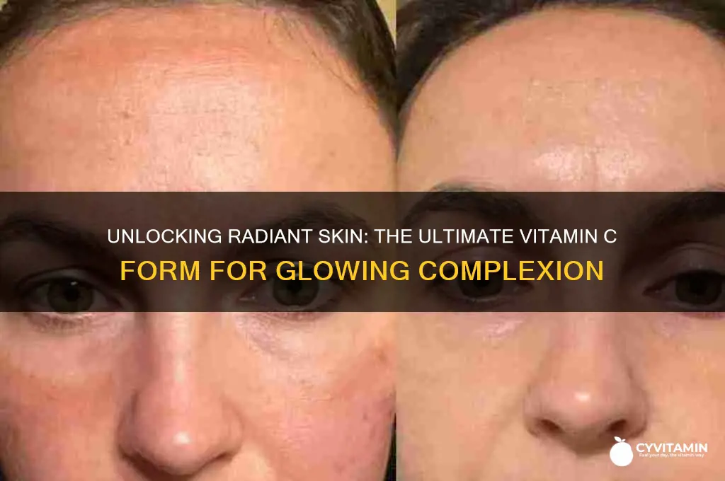 what is the best form of vitamin c for skin
