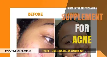 Top Vitamin A Supplements for Clearer Skin and Acne Relief