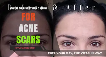 Top Vitamin C Serums to Fade Acne Scars Effectively