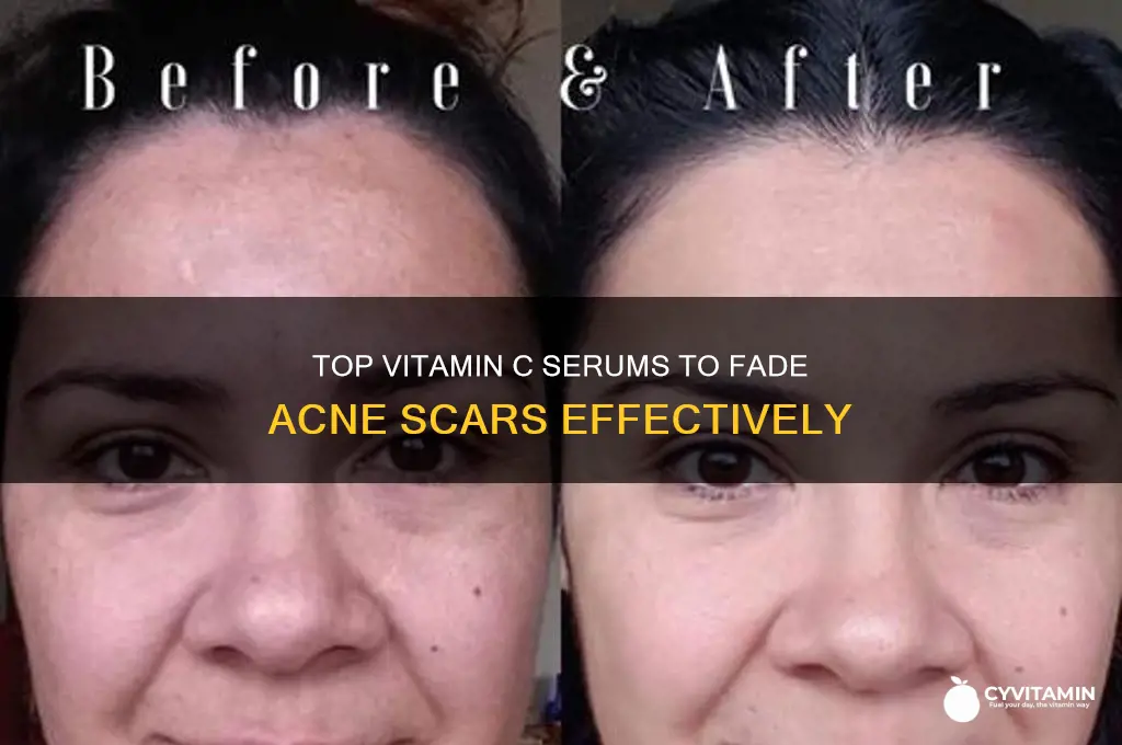 what is the best vitamin c serum for acne scars
