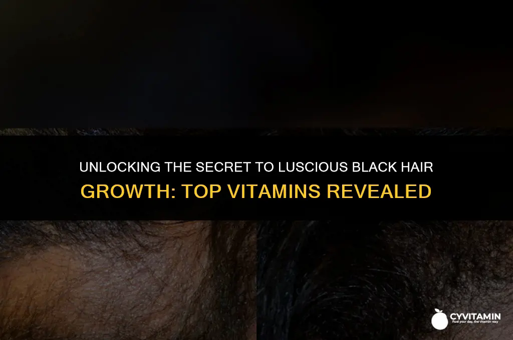 what is the best vitamin for black hair growth