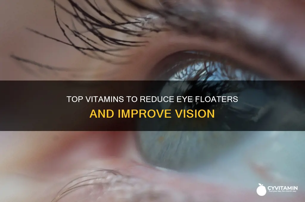 what is the best vitamin for eye floaters