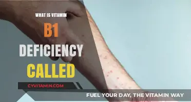 Understanding Beriberi: The Condition Linked to Vitamin B1 Deficiency