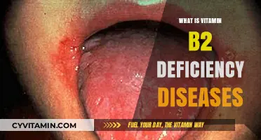 Understanding Vitamin B2 Deficiency: Symptoms, Causes, and Treatments