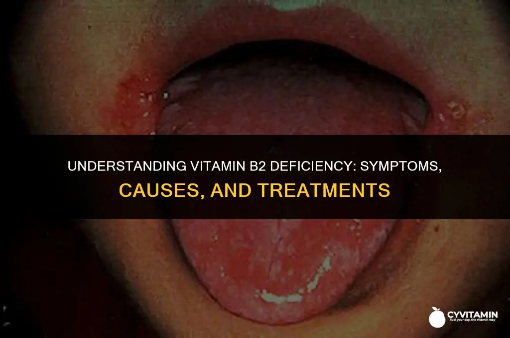 what is vitamin b2 deficiency diseases