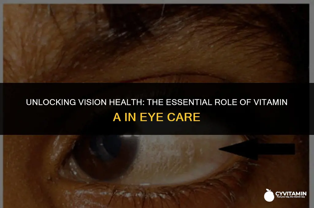 what role does vitamin a have in the eye