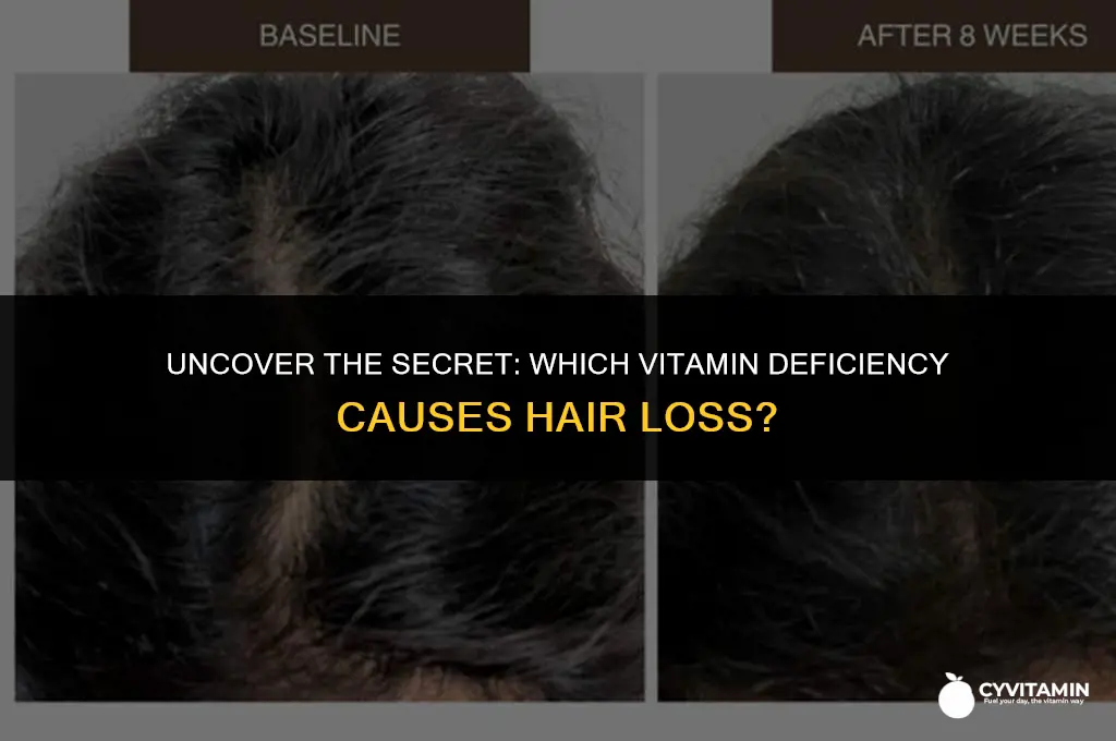 what vitamin am i lacking for hair loss