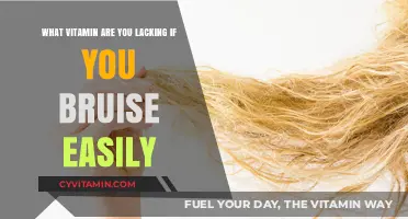 Uncover the Hidden Culprit: Vitamin Deficiencies That Cause Easy Bruising