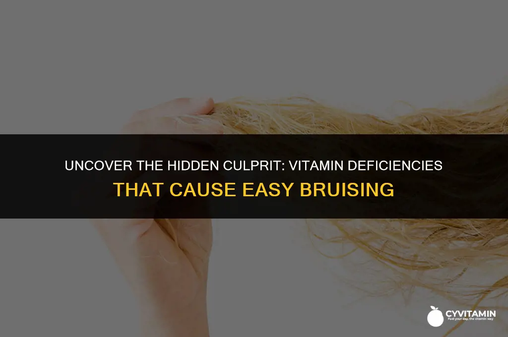 what vitamin are you lacking if you bruise easily