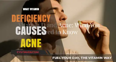 Unveiling the Culprit: Which Vitamin Deficiency Triggers Acne?