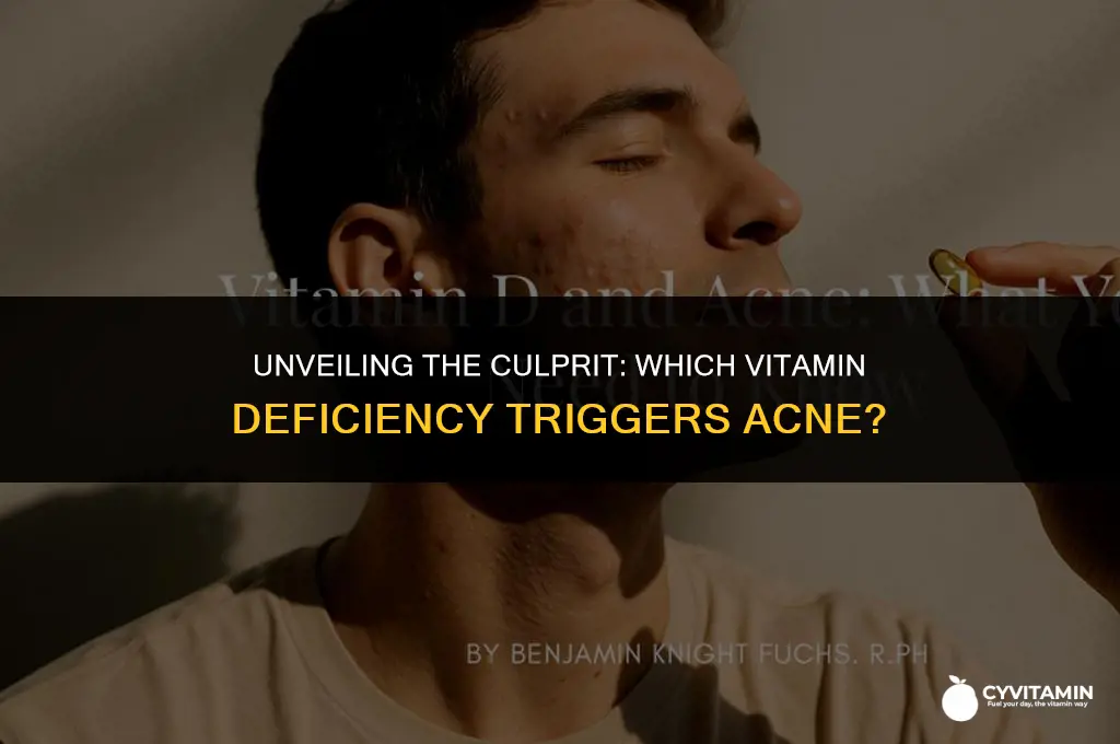 what vitamin deficiency causes acne