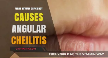 Unveiling the Culprit: Which Vitamin Deficiency Triggers Angular Cheilitis?