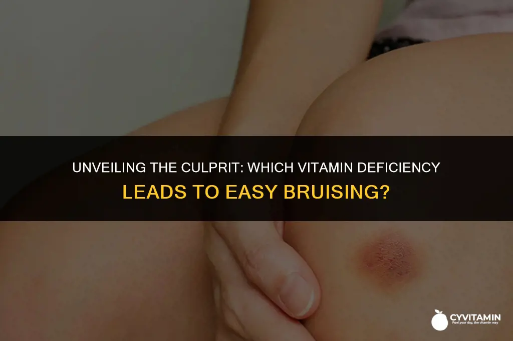 what vitamin deficiency causes bruising