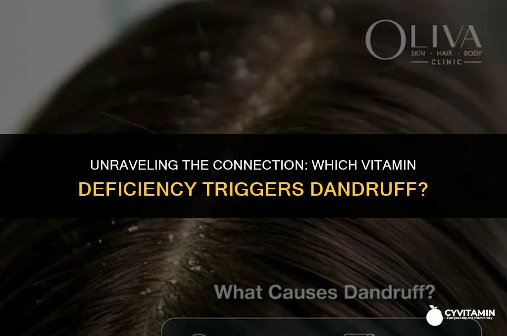 what vitamin deficiency causes dandruff