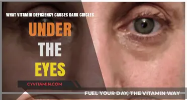 Uncover the Secret: Which Vitamin Deficiency Leads to Dark Circles?