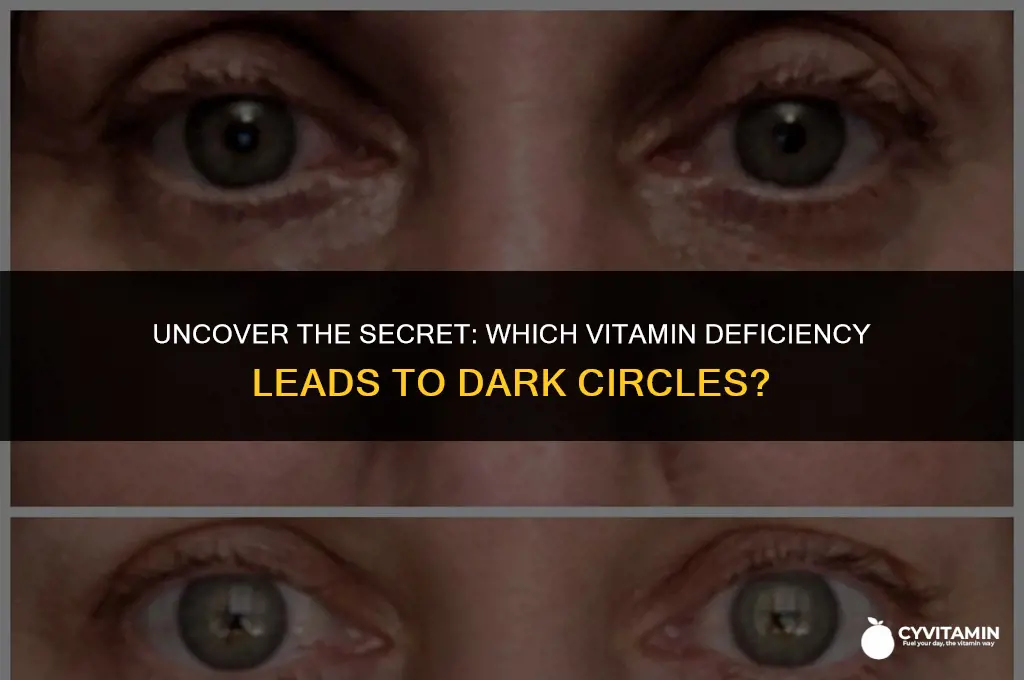 what vitamin deficiency causes dark circles under the eyes