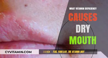 Unveiling the Culprit: Which Vitamin Deficiency Triggers Dry Mouth?
