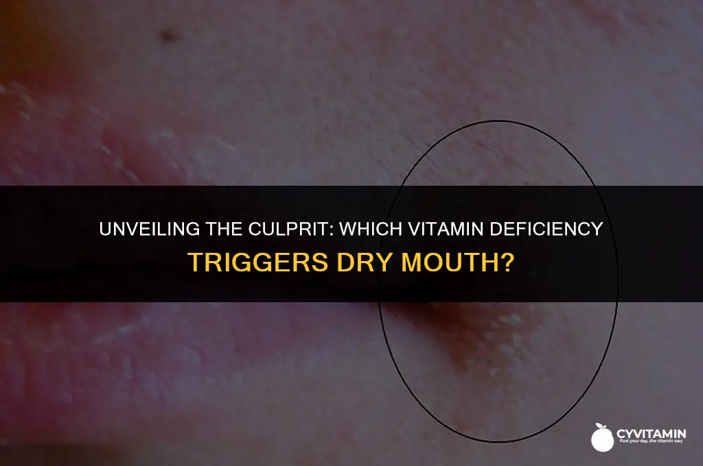 what vitamin deficiency causes dry mouth
