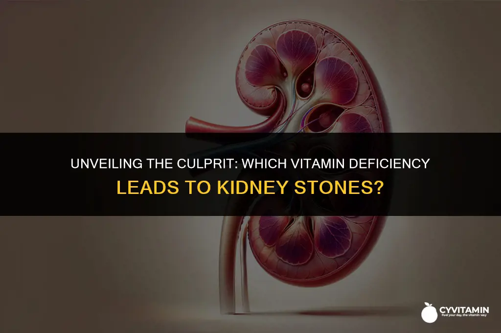 what vitamin deficiency causes kidney stones
