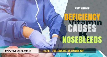 Unveiling the Surprising Link Between Vitamin Deficiency and Nosebleeds