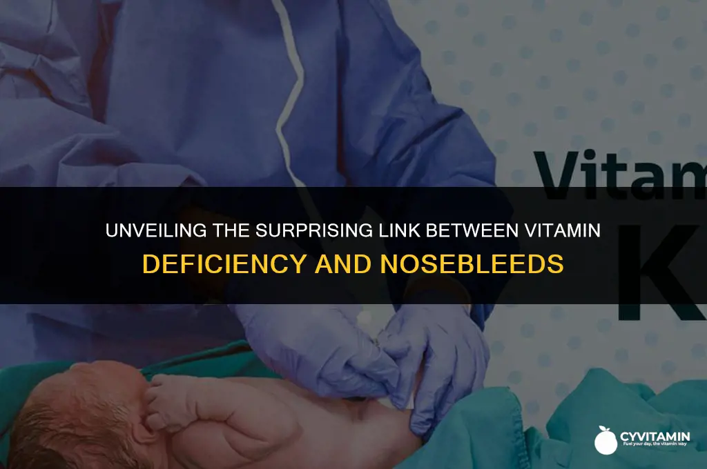 what vitamin deficiency causes nosebleeds