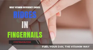Unveiling the Culprit: Which Vitamin Deficiency Triggers Ridges in Fingernails?