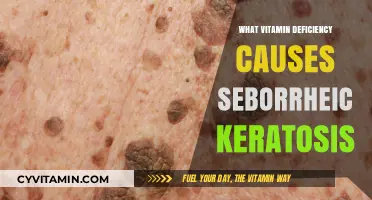 Unveiling the Vitamin Deficiency Linked to Seborrheic Keratosis