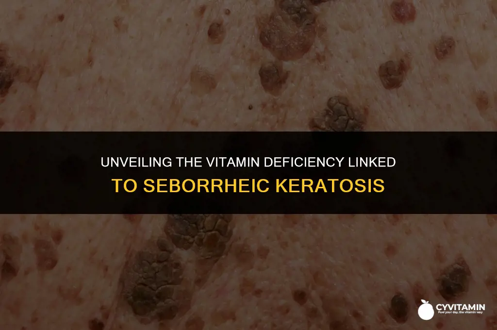 what vitamin deficiency causes seborrheic keratosis