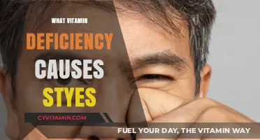 Unveiling the Culprit: Which Vitamin Deficiency Triggers Styes?