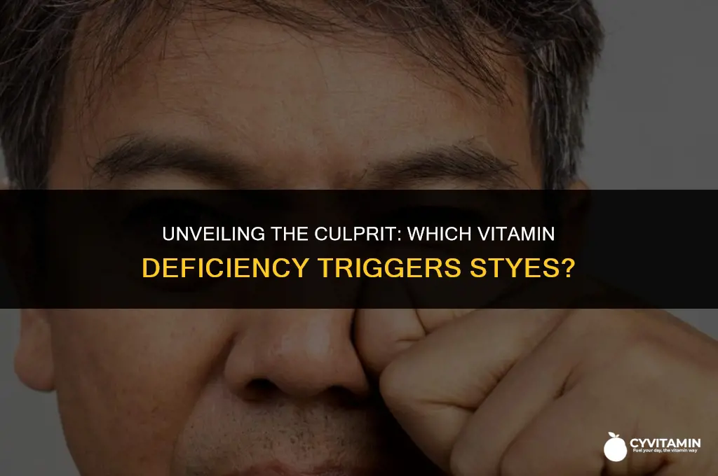 what vitamin deficiency causes styes