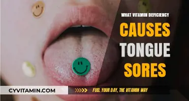 Unraveling the Mystery: Which Vitamin Deficiency Triggers Tongue Sores?
