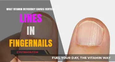 Unveiling the Culprit: Vitamin Deficiency Linked to Fingernail Lines