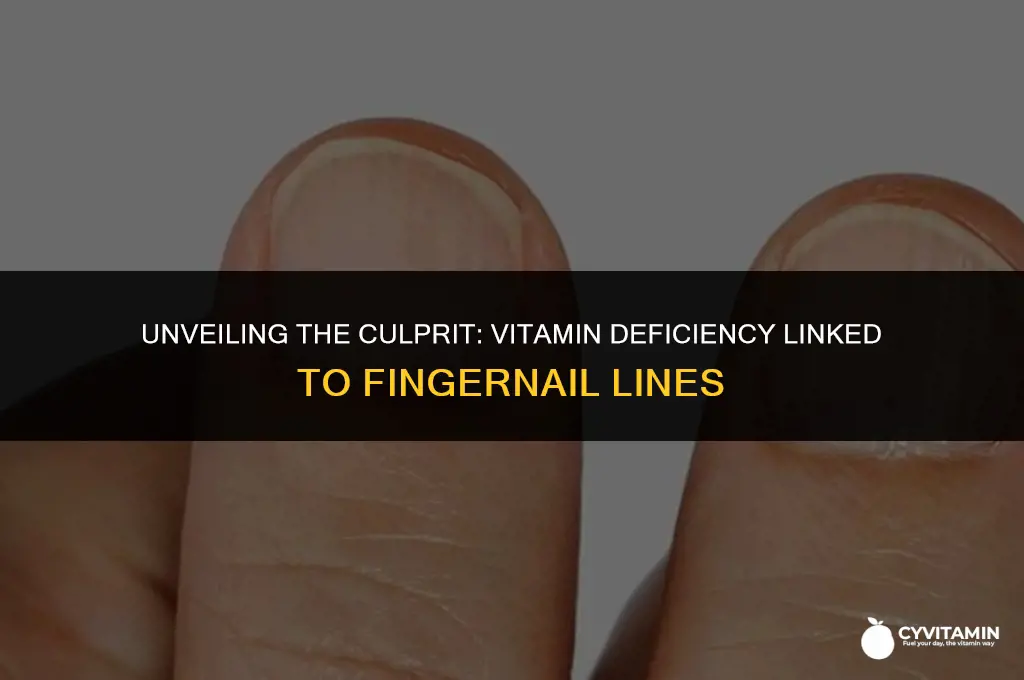 what vitamin deficiency causes vertical lines in fingernails