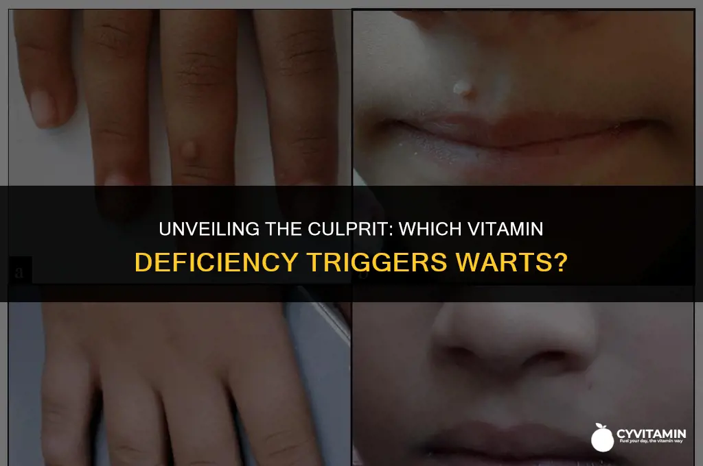 what vitamin deficiency causes warts