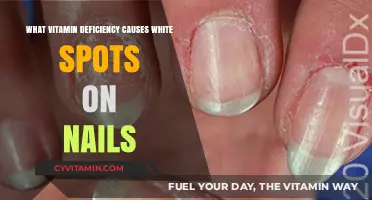 Unveiling the Culprit: Which Vitamin Deficiency Causes White Spots on Nails?