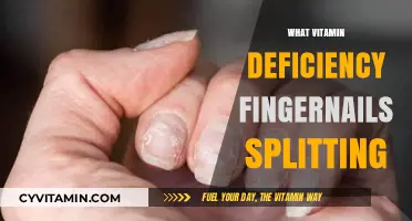 Brittle to Beautiful: Conquering Vitamin Deficiencies for Healthy Nails