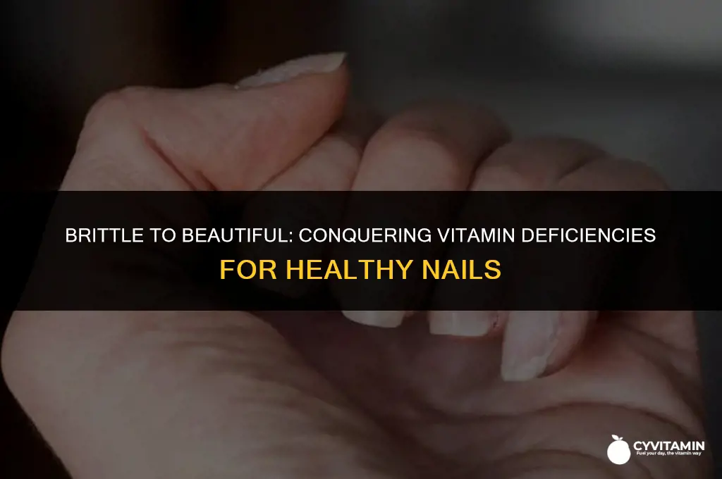 what vitamin deficiency fingernails splitting