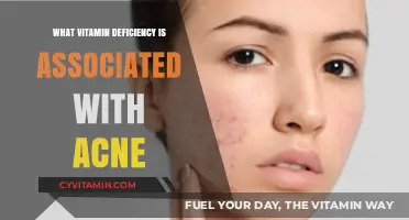 Unveiling the Link: Vitamin Deficiencies That Trigger Acne