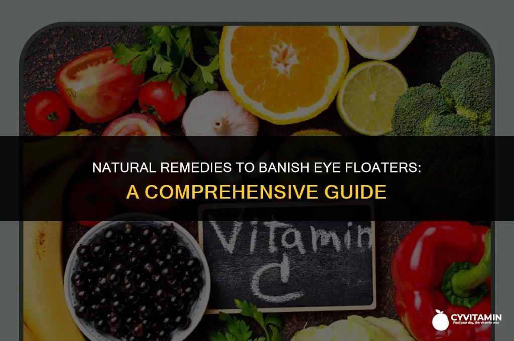 what vitamin gets rid of floaters