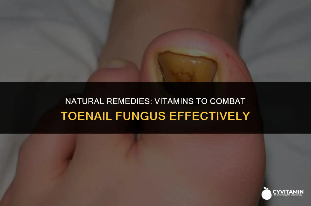 what vitamin is good for toenail fungus