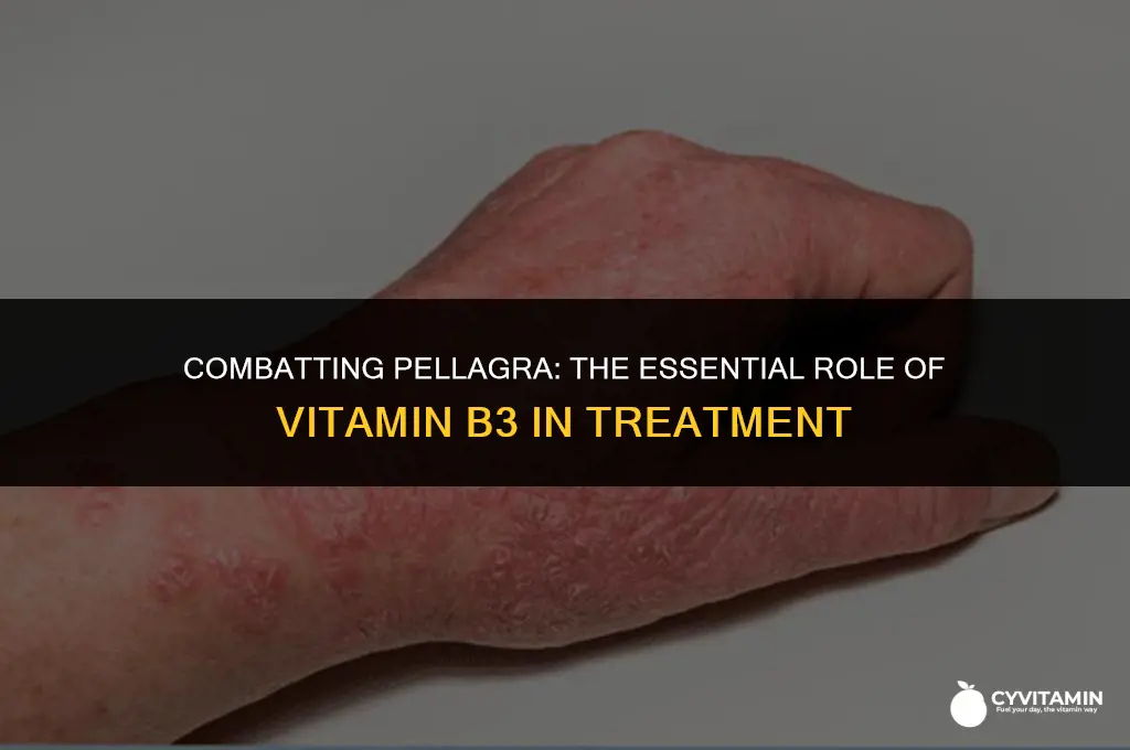 what vitamin is used to treat pellagra