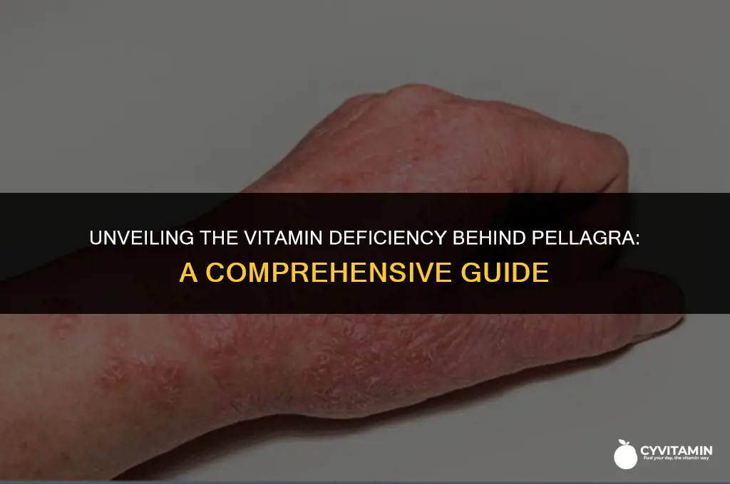 what vitamin may be deficient in the disease pellagra