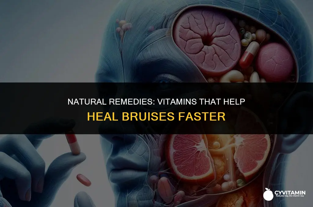 what vitamins are good for bruises